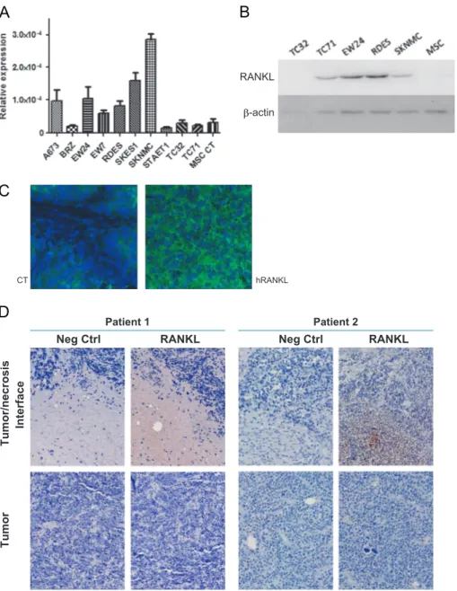 Fig. 1. Validation of the presence of RANKL in the Ewing's sarcoma tumor microenvironment