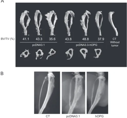 Fig. 4. Effect of OPG gene transfer on bone lesions associated with EWS progression in mice