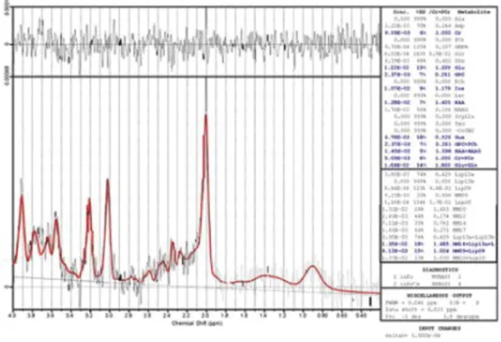 Figure 2.1. Example of a metabolite spectrum 