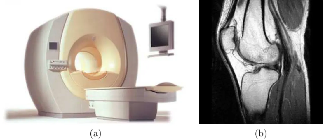 Fig. 1.3 – Imageur et image IRM. (a) Un appareil IRM propos´e par Philips (Photo :www.ncdmedical.com/images/mri/philipsintera.jpg)