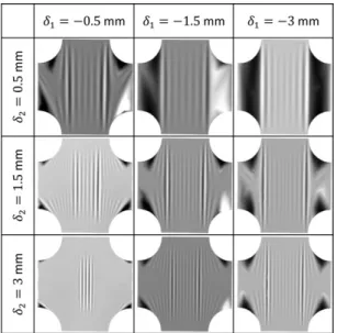 Fig. 8. Sample of experimental data processing (specimen thickness = 25 l m).