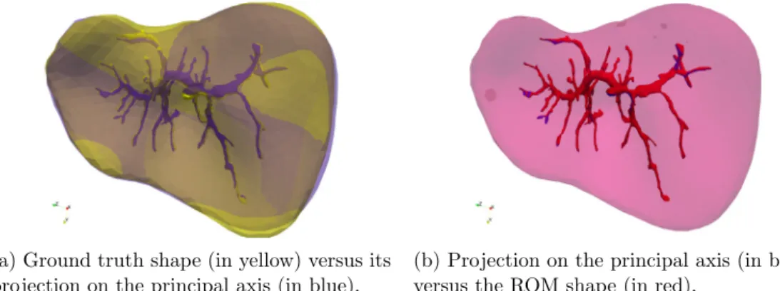 Fig. 10. Comparison of the shape and the portal vein representations produced by the different steps (the portal vein allows to visually assess the accuracy of the volume reconstruction)