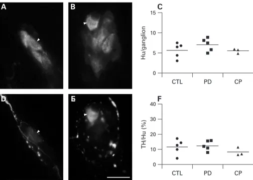 Figure 1 Submucosal neuron counts and dopaminergic phenotype are unchanged in patients with Parkinson’s disease (PD)