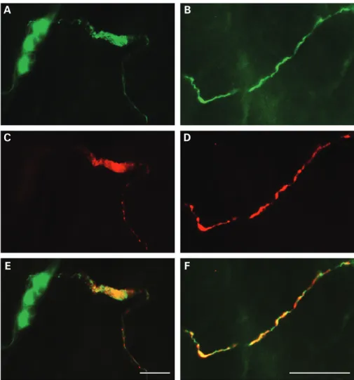 Figure 2 Phospho-a-synuclein-positive submucosal neurites differentiate Parkinson’s disease patients from controls