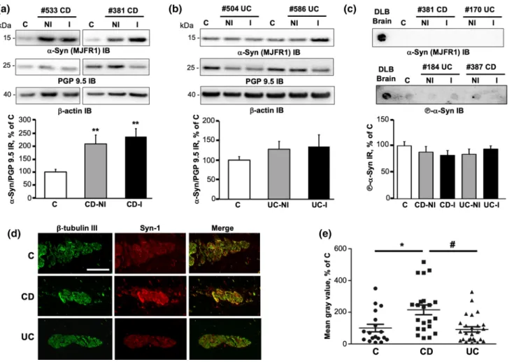 Fig. 1    Expression levels and aggregation of alpha-synuclein in  colonic biopsies from patients with Crohn’s disease (CD) and  ulcera-tive colitis (UC)