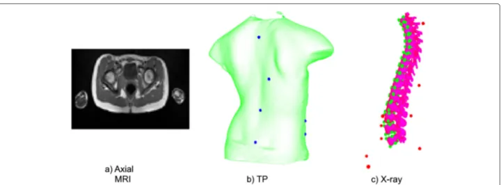 Figure 2 Medical image modalities. Multimodal image data used for the 3D patient representation developed