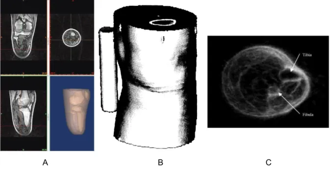 Figure 2.7 – Exemples de géométries du membre amputé - A/Reconstruction par IRM [Sen- [Sen-geh 13] B/Reconstruction par tomodensitométrie [Smith 95] C/ Utilisation des ultrasons  [Dou-glas 02].