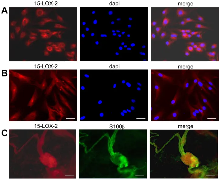 Figure 3. Human and rat EGC express the 15-lipoxygenase-2. 