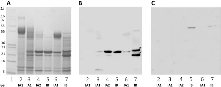 Fig 3. TLR2 binding to P. acnes surface proteins. P. acnes surface proteins were extracted from a 5-day culture bacterial pellet and separated by electrophoresis in a 4–12% NuPAGE LDS BisTris gel (50 μg) with detection by Coomassie blue staining (A)