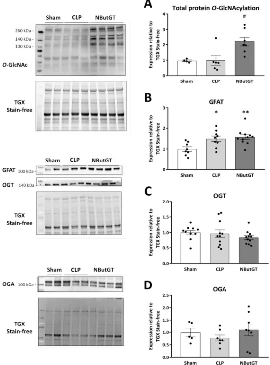 Figure 2.  Impact of septic shock and O-GlcNAc stimulation were evaluated by immunoblot analysis for  the major proteins involved in O-GlcNAc pathway regulation