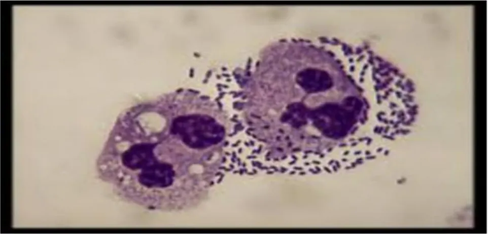 Figure 10 : aspect microscopique de Streptococcuspneumoniae(HAMAM Kahina ., 2018). 