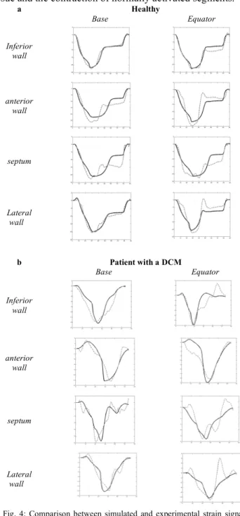 Fig.  3:  Bond  Graph  model  of  the  coupled  myocardial  segments  and  a  simplified circulatory network