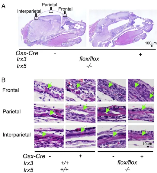 Fig. 4. Osteoblastic bone mineralization is reduced in Irx3 ﬂox/ﬂox /Irx5 −/− /Osx-Cre + skulls