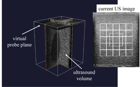 Figure 10: Ultrasound simulator: 3D view of the ultrasound volume and the initial ultrasound image ob- ob-served by the virtual probe with the 25 speckle patches (grid) and the in-plane tracking region of interest (biggest box)