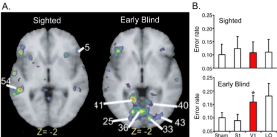 Figure 2. Occipital recruitment during linguistic tasks in the early blind brain. (A)  Differential  activations  observed  in  a  group  of  sighted  and  early  blind  subjects  during  a  covert  verb  generation  task  implying  the  generation  of  se