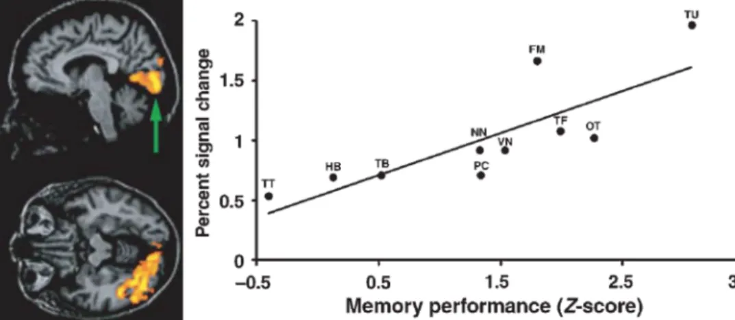 Figure  3.  Occipital  involvement  in  episodic  verbal  memory  in  the  early  blind  brain