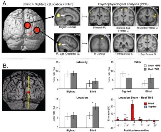 Figure 4. Recruitment of right dorsal occipital regions for spatial hearing in early  blind  individuals