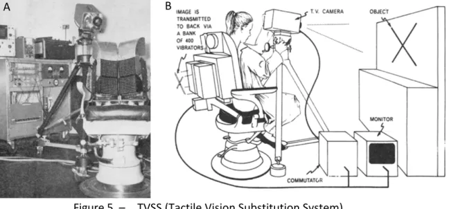 Figure 5. –   TVSS (Tactile Vision Substitution System) 