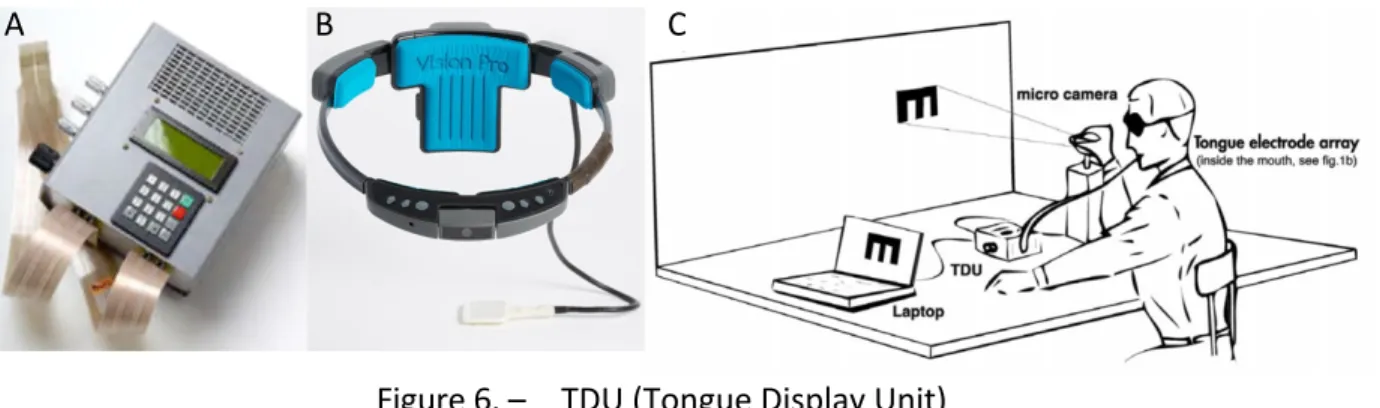 Figure 6. –   TDU (Tongue Display Unit) 