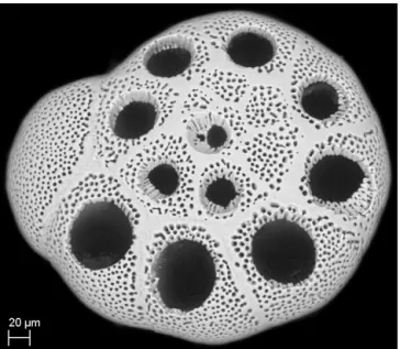 Figure 1. Scanning electron microscope (SEM) image of A. tepida specimen after laser ablation analysis of multiple chambers