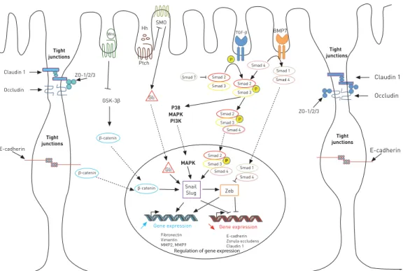 FIGURE 3 Cell signalling involved in epithelial–mesenchymal transition. ZO: zonula occudens; Wnt: wingless tail; Hh: