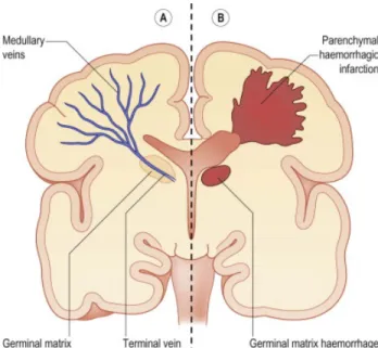 Figure 1. –   Cross section of brain and outlying germinal matrix (33) 