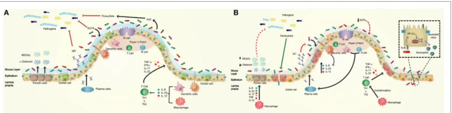 FigURe 1 | Normal intestinal epithelium versus altered intestinal epithelium observed in inflammatory bowel disease (iBD)