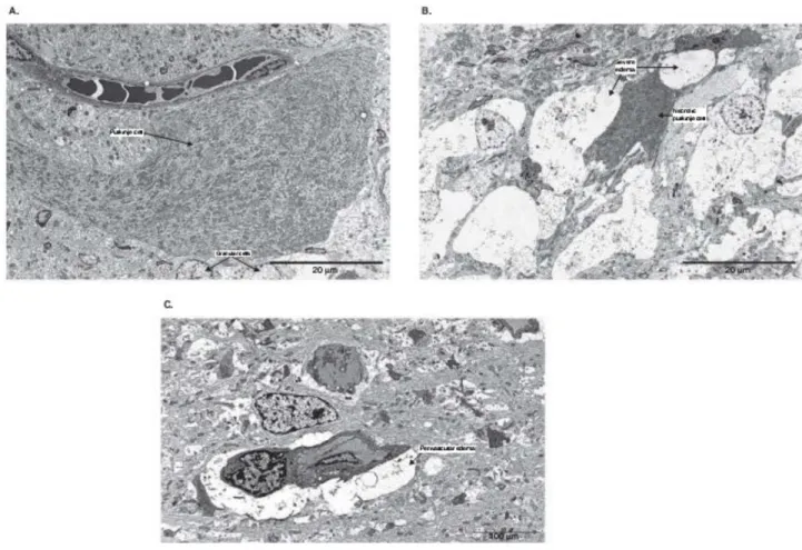 Figure 2.   (A) Cerebellum from a sham operated control pig. A normal Purkinje cell and capillary without any signs  of perivascular edema