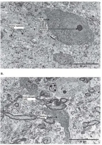 Figure 3.   (A) Brain stem from a sham operated pig. Neuron with a distinct nucleolus without any signs of 