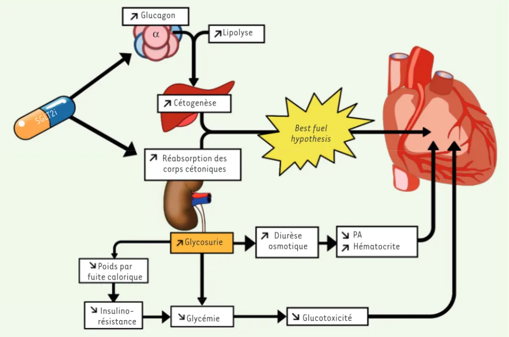 Figure 3.  Mécanismes cardioprotecteurs potentiels des SGLT2i. Diminution de la glycémie indépendante de l’insuline par augmentation de la  glycosurie, diminution de la pression artérielle (PA) et augmentation de l’hématocrite