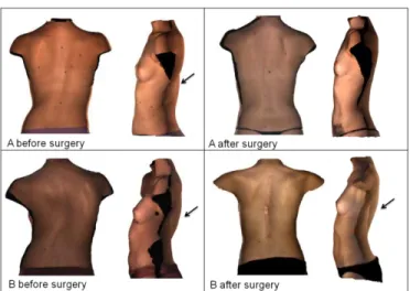 Fig.  10.    Functional  measurements  of  patients  A  and  B  before  and  after  surgery