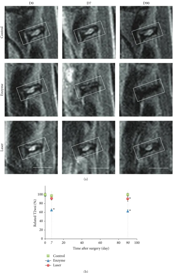 Figure 1: MRI images (T2-weighted midsagittal) and analysis of rabbit lumbar spines. Intervertebral discs of 1-year-old rabbits were treated according to either the enzyme technique (enzyme) or the laser procedure (laser) as described in Materials and Meth