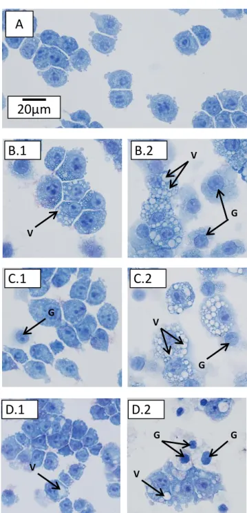 Figure  4  . Morphology  of  macrophages  observed  after  20h  incubation  with  nanoparticles  and  May  Grünwald Giemsa staining (x600)
