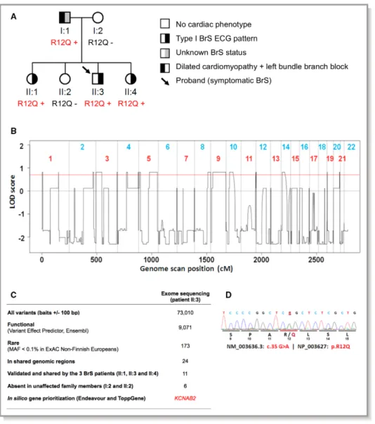 Figure 1A), whose BrS phenotype could not be determined, because no drug challenge test could be performed in the presence of dilated cardiomyopathy