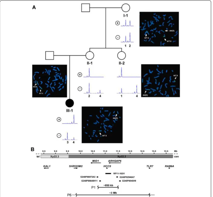 Figure 1 Pedigree, FISH and X chromosome inactivation of patient 1 and three healthy female relatives