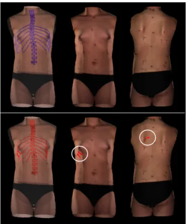 Fig.  10  shows  the  average  distances  between  the  ribs  and  the surface topography, obtained on the whole cohort for each  portion  of  the  ribs  and  all  over  their  length  (Total)