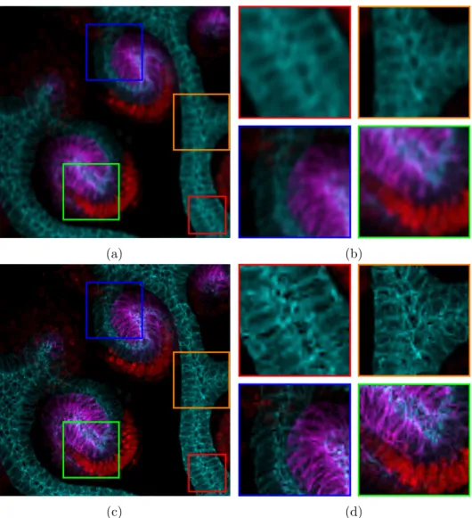 Figure 6: A deconvolution example. The confocal image Figure 3 has been blurred with blur Figure 4a and degraded with a noise level of 5.10 −3 