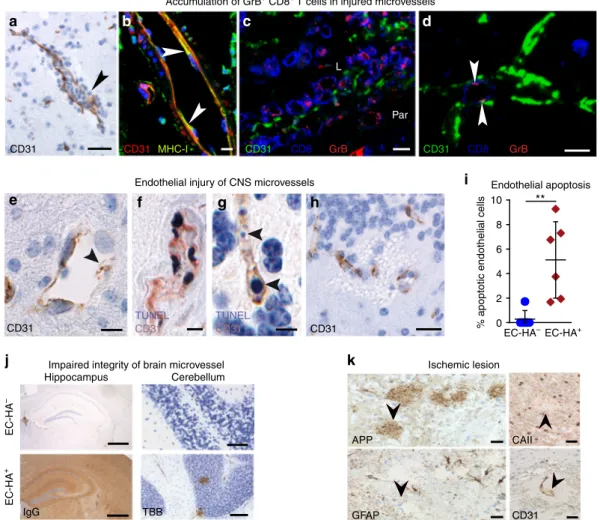 Fig. 6 CTLs accumulate in damaged microvessels of EC-HA + mice. Representative brain images of EC-HA + mice 4 days after adoptive transfer of cytotoxic CD8 + T cells (n = 6)