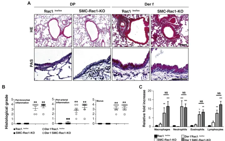 FIG 4. SMC-Rac1 deletion has no effect on pulmonary remodeling associated with allergic asthma.