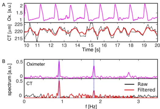 Figure 10. –   A) Frequency spectrum analysis of CT fluctuations in time, showing the oximeter signal,  raw fluctuations of CT versus time (black) and band-pass filtered CT signal (red)