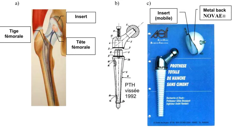 Figure 1 Prothèses totales de hanche : a) prothèse de Charnley [6]; b) tige PROFIL ®  ; c) Tige vissée PF et  cupule NOVAE® (Documents internes société SERF) 