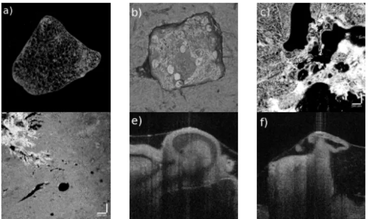 Fig. 2. (a) grape (b) kiwi (c) banana (d) chicken (e &amp; f) mice epithelium system