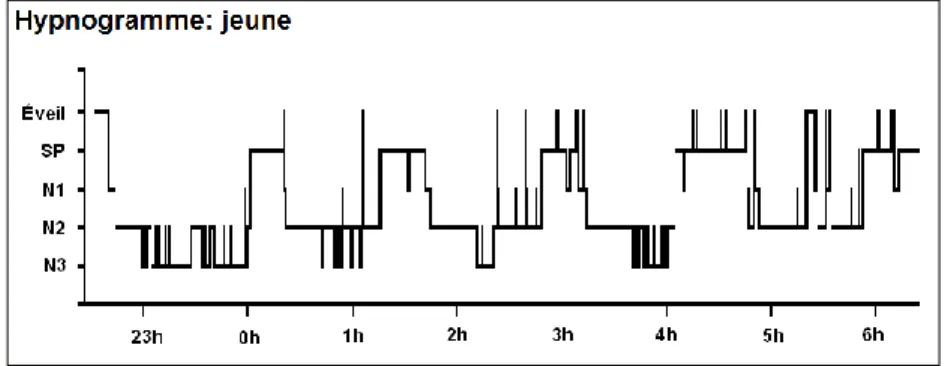 Figure 1. Hypnogramme d’un jeune adulte. Les stades de sommeil sont  représentés en  fonction de l’heure