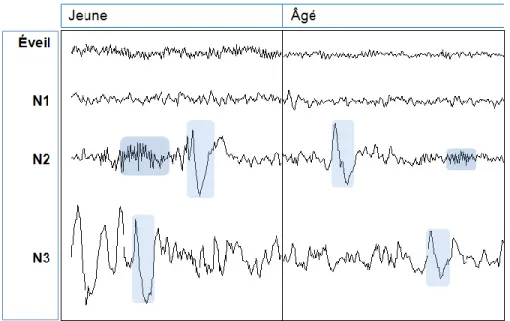 Figure 4. Tracés de l’EEG selon l’âge. Exemples de tracés de l’EEG chez une personne  de 25 ans (à gauche) et une personne de 60 ans (à droite)