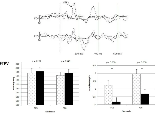 Figure A.1 Grand average waveforms at FC5 and FC6: The upper panel illustrates grand- grand-averaged ERPs elicited by human voices (dotted) and by piano tones (dashed), referenced to the  standard pure tones stimuli (black) at two temporal electrodes, name