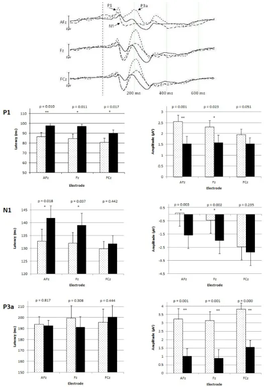 Figure A.2 Grand average waveforms at AFz, Fz and FCz: The upper panel illustrates grand- grand-averaged ERPs elicited by human voices (dotted) and by piano tones (dashed), referenced to the  standard pure tones stimuli (black) at three midline electrodes,