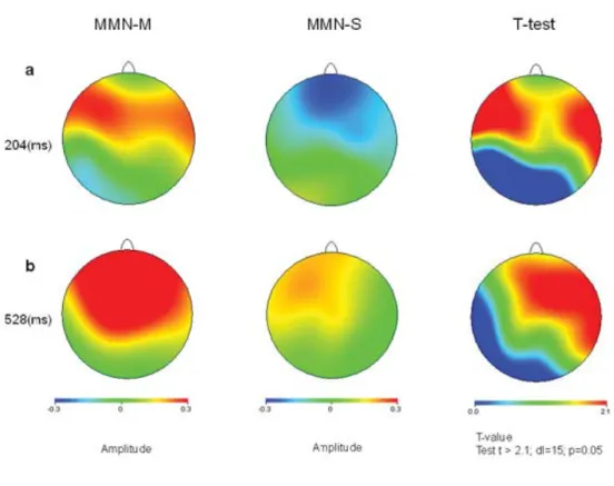 Figure 2: Brain topographies. 