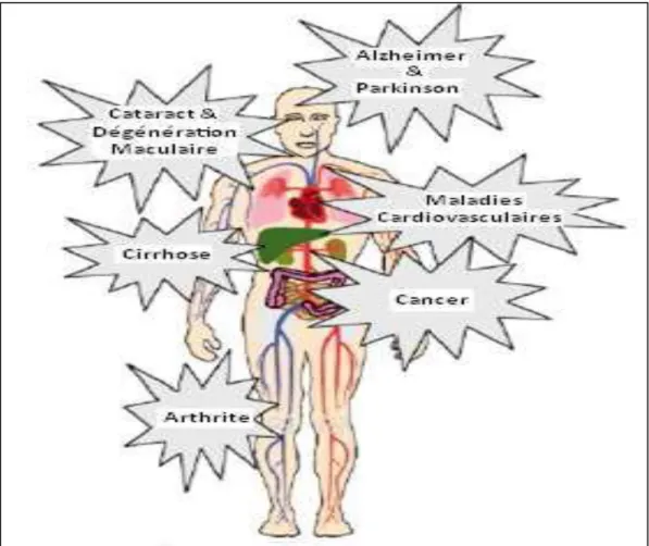 Figure 07: ROS et Maladies (Mohammedi,  2012). 