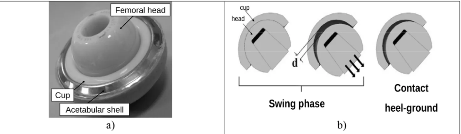 Figure 1. a) Hip prosthesis and b) Microseparation phenomena, d represents the distance of  microseparation 3,4 