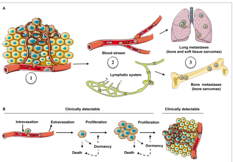 FiGURe 1 | The metastatic process in sarcoma and possible fates of cancer cells in secondary site